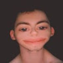 koxix