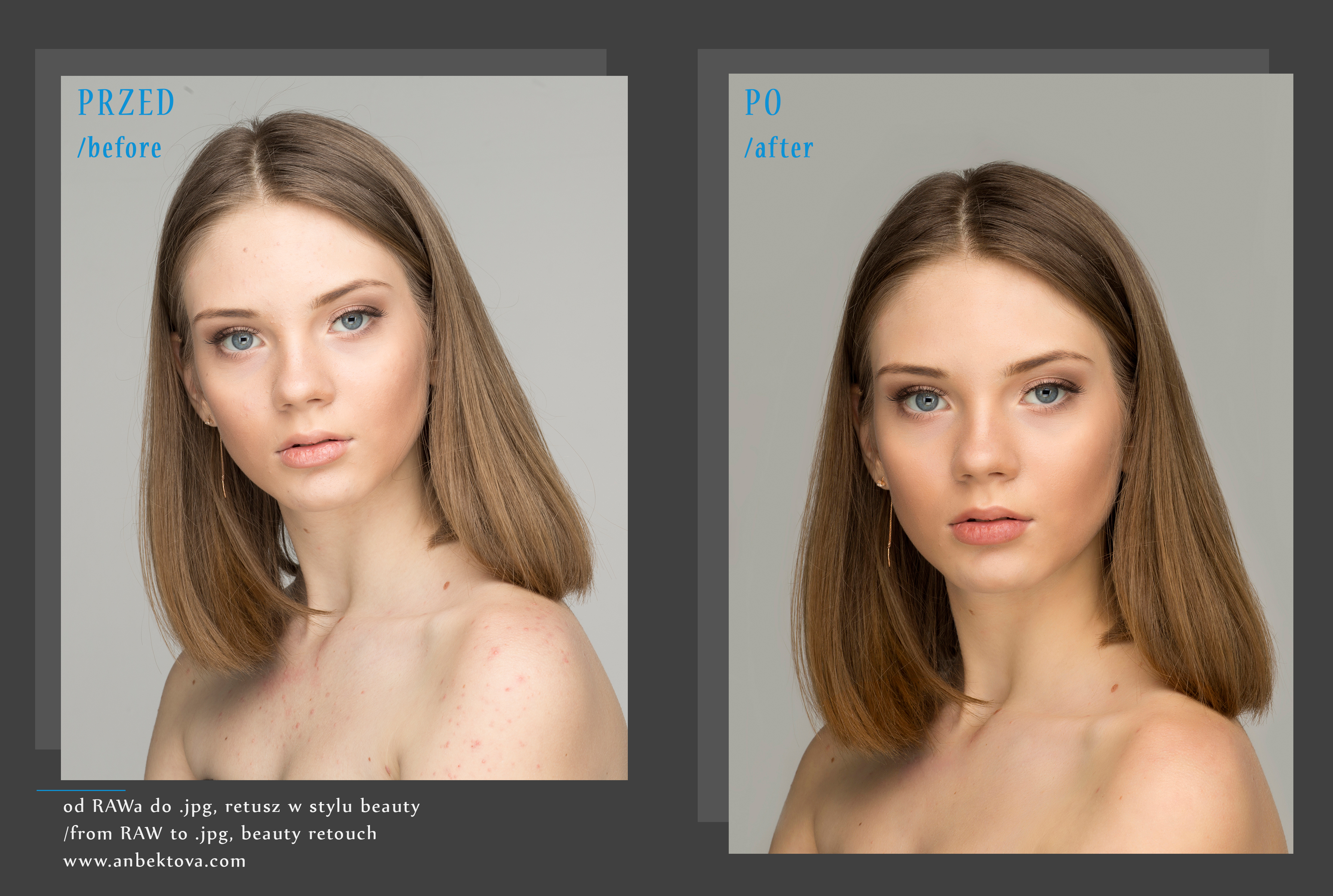 Portfolio item